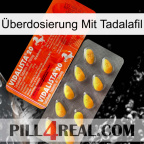 Überdosierung Mit Tadalafil new01